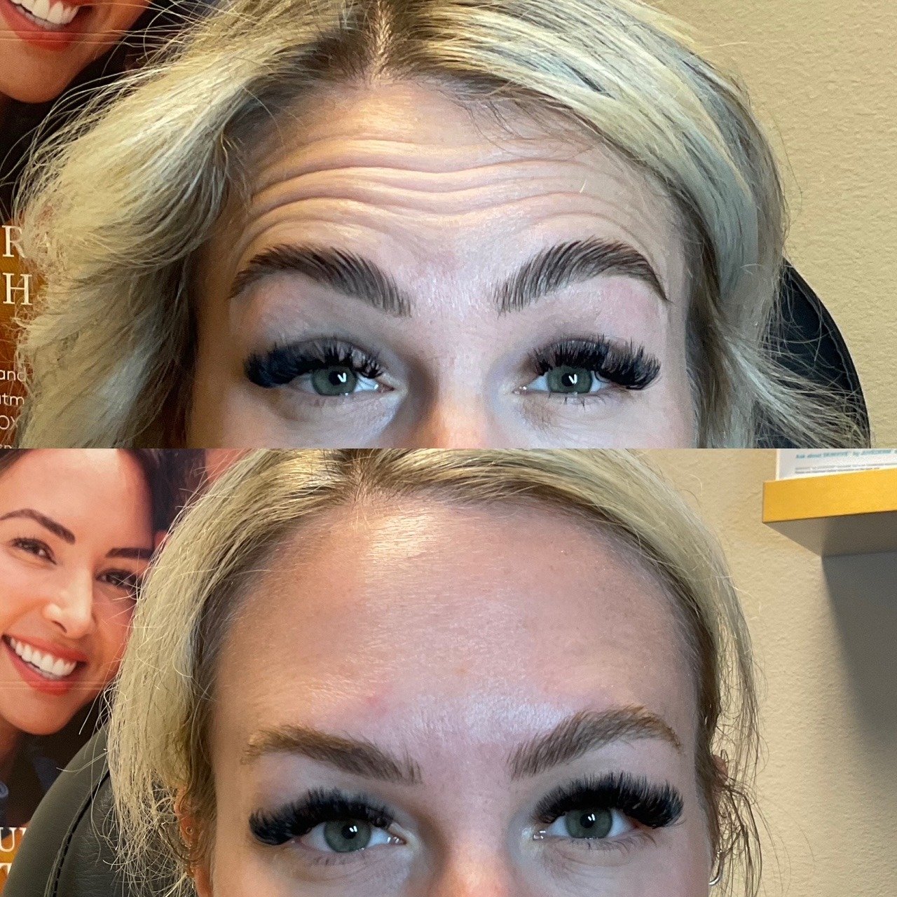 Wrinkle Relaxer Results