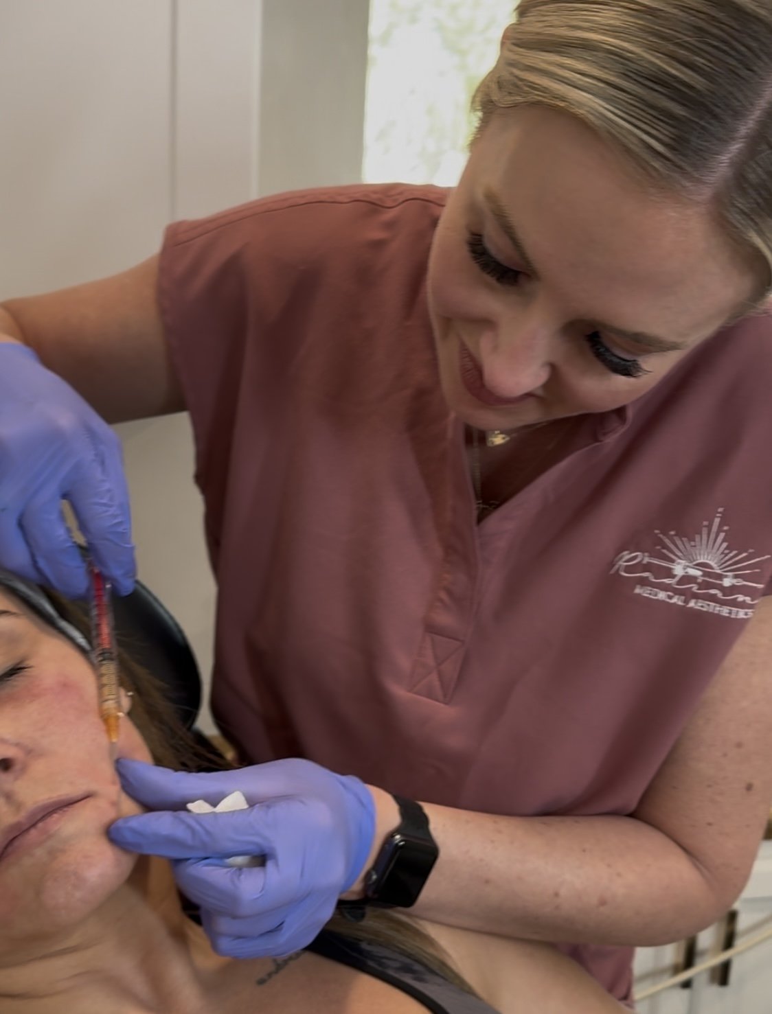 Dermal filler treatment planning