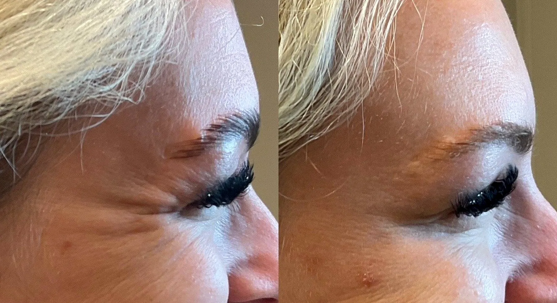 Wrinkle Relaxer Planning